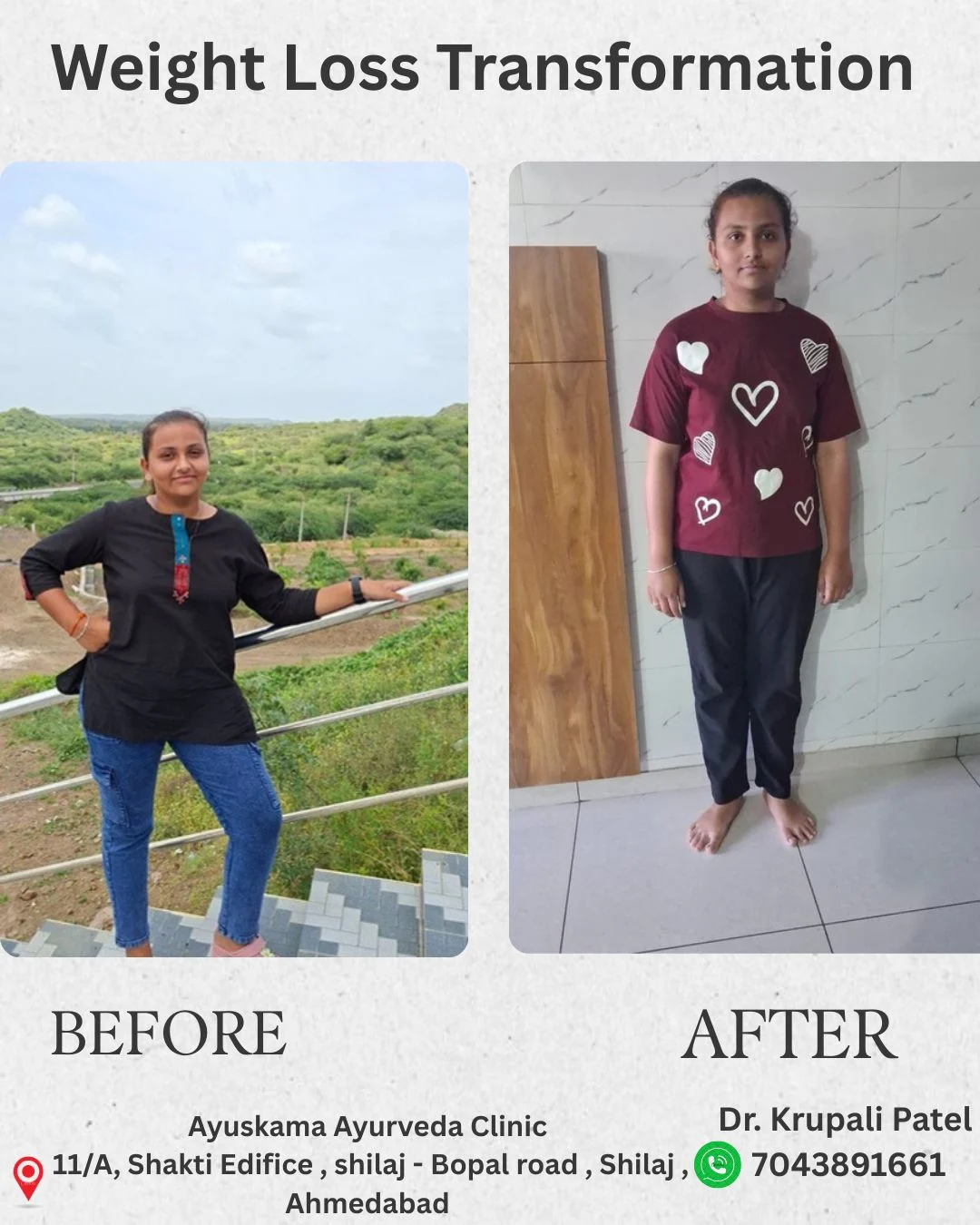 Weight Loss Transformation