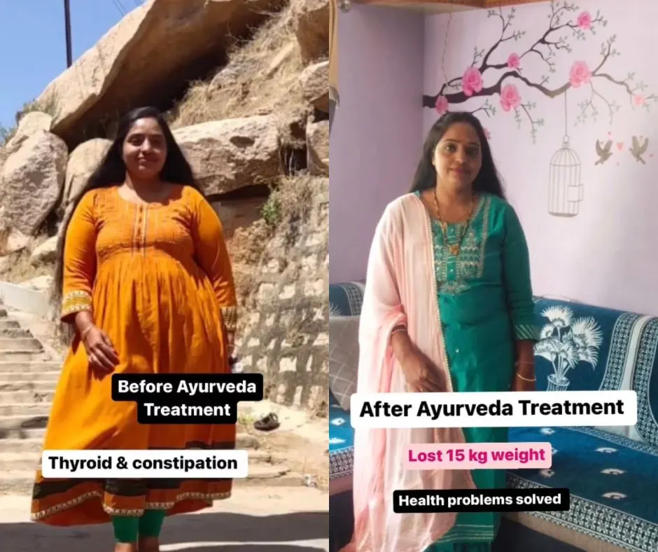 Thyroid & Constipation, 15 kg Reduction